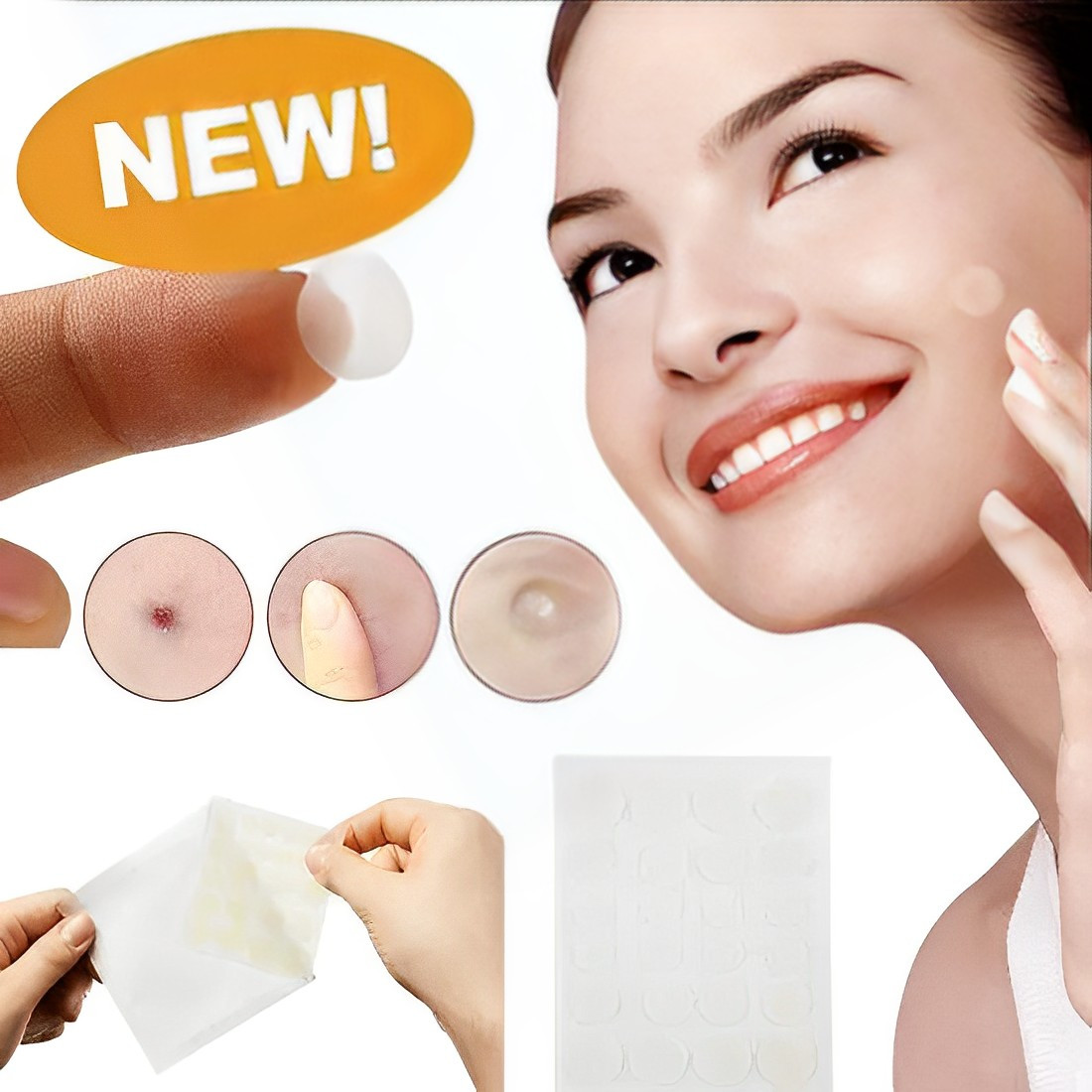 ПЛАСТИР ВІД ПАПІЛОМ, АКНЕТА БОРОДАВОК ACNE PATCH
