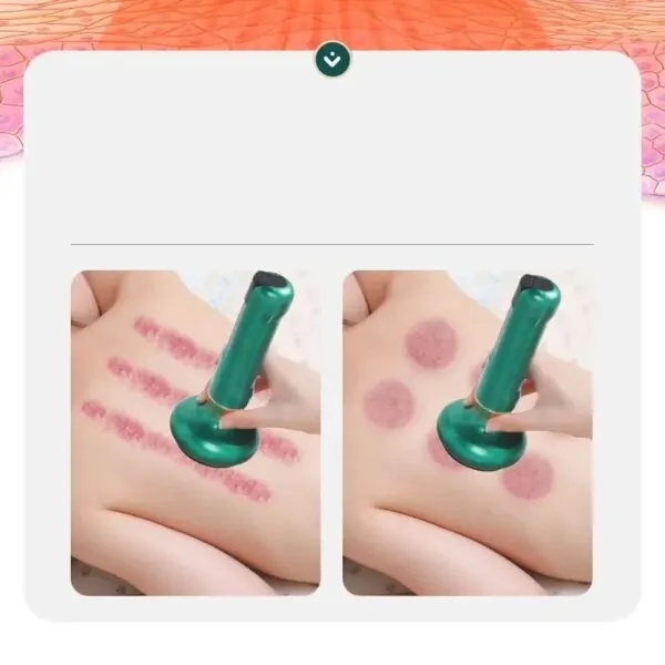 Вакуумний антицелюлітний масажер для тіла Cupping Massager GREEN - Зображення 5