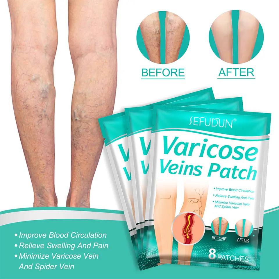 ПАТЧІ ВІД ВАРІКОЗУ VARICOSE PATCH 8 шт